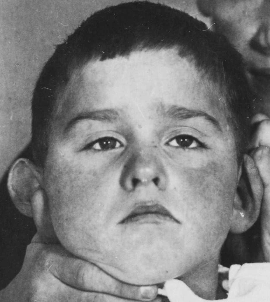 Detlev Davids (f�r das Foto wurde der Kopf gest�tzt)